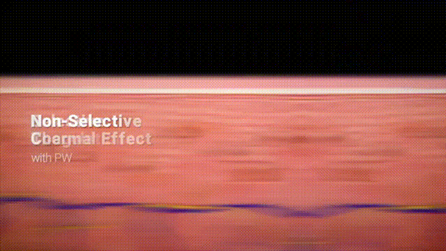 去韓國做黃金微針多少錢？首爾探店真實物價，不看怕你被宰插图2