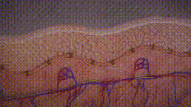 去韓國做黃金微針多少錢？首爾探店真實物價，不看怕你被宰插图1